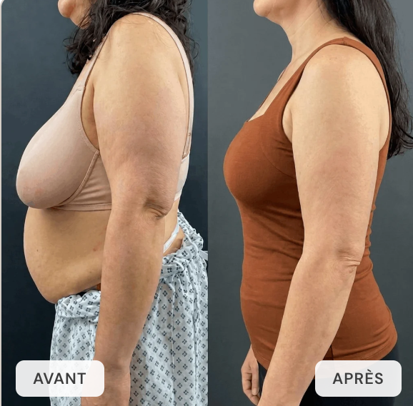 Julie, 57 ans